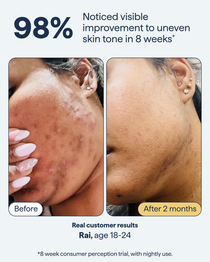 Remedy Dark Spot Correcting Advanced Serum