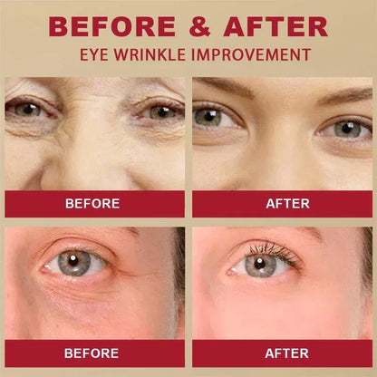 Seoul 1988 Bright Eyes Cream – Dark Circle & Wrinkle Repair & Anti-Aging Hydrating | Korean Formula