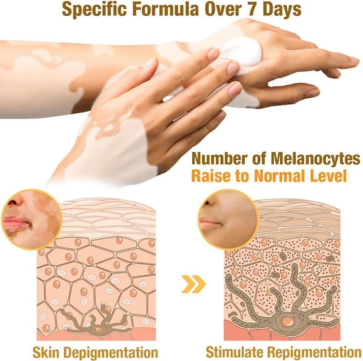 Vitiligo Bee Venom, Whitening Body Skin Care Cream