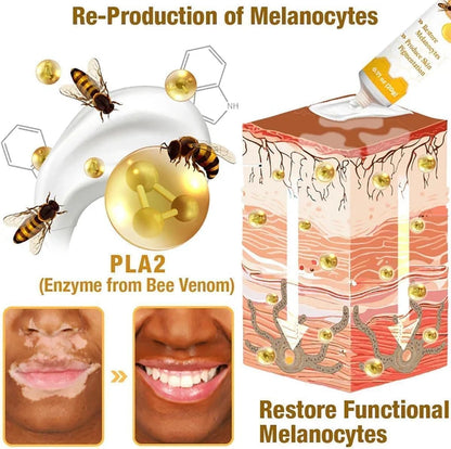 Vitiligo Bee Venom, Whitening Body Skin Care Cream