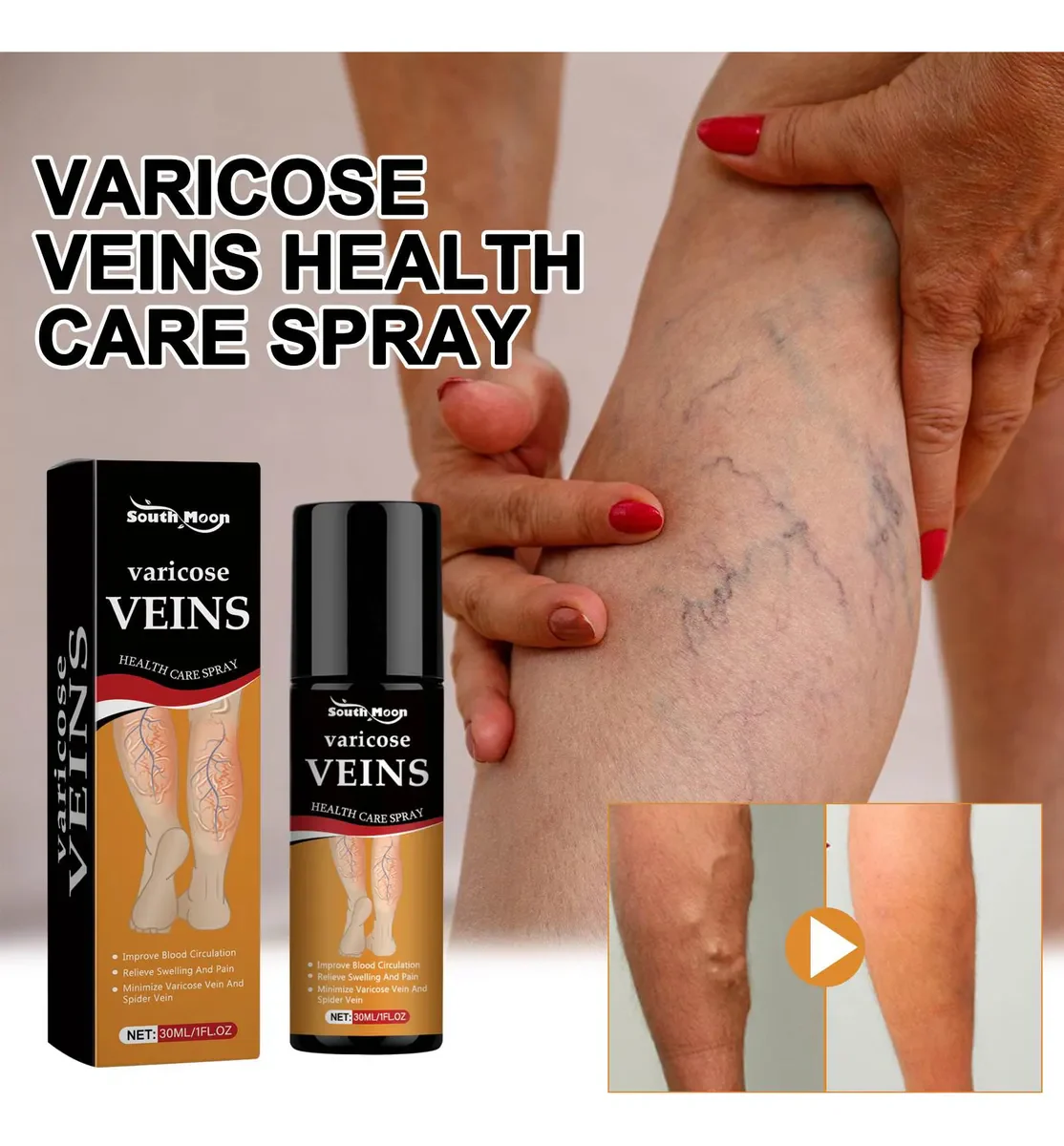 Turmeric Herbal Vericose Vein Relief Spray | With Free Delivery