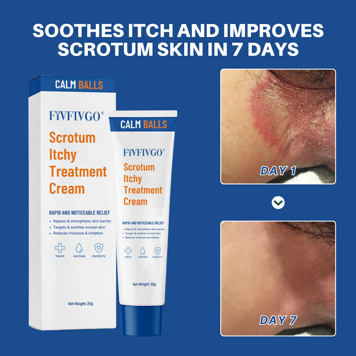 Scrotum Itchy Treatment Cream With Free Delivery