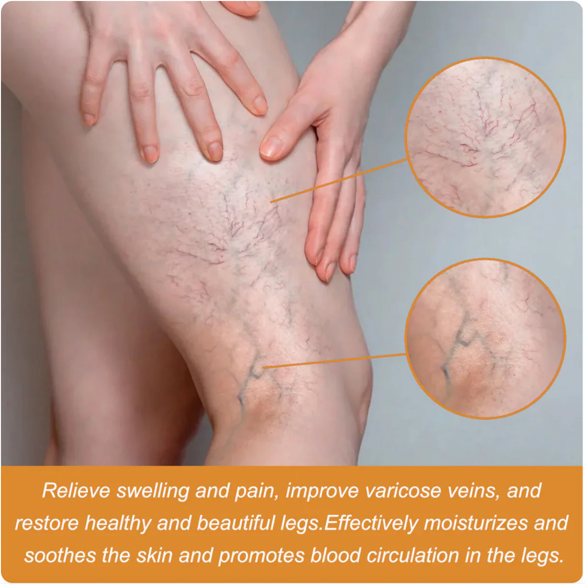 Turmeric Herbal Vericose Vein Relief Spray | With Free Delivery