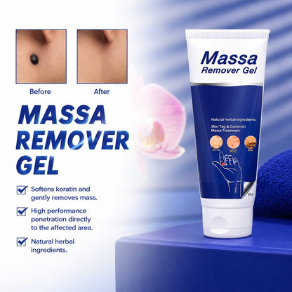 Massa Remover Gel With Free Delivery