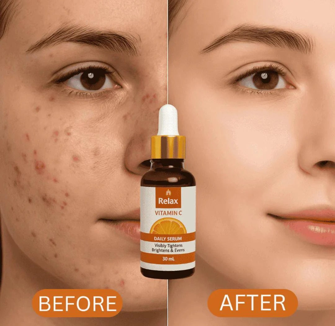 RELAX | FACE SERUM 30ML (VITAMIN C) With Free Delivery