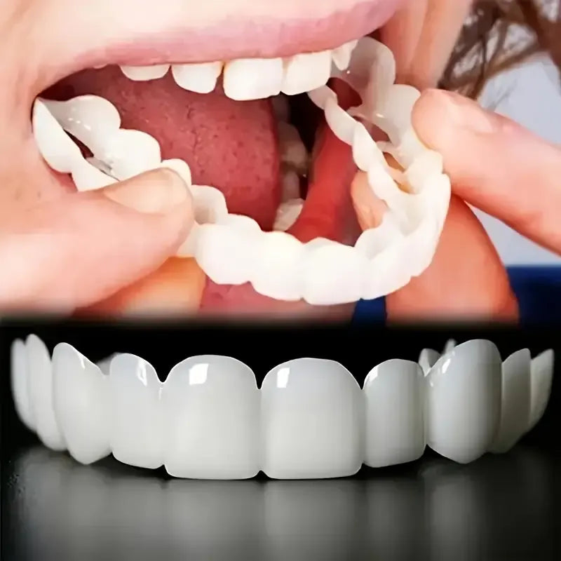 2 Pairs Snap-On Teeth Covers – Natural Look, Instant Smile Upgrade