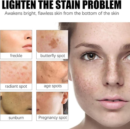 Dark Spot Removal Urea Vitamin E Cream With Free Delivery
