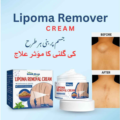 South Moon Lipoma Removal Cream With Free Delivery