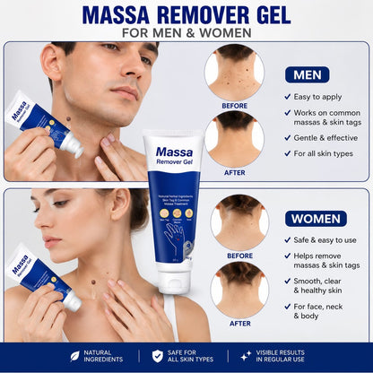 Massa Remover Gel With Free Delivery
