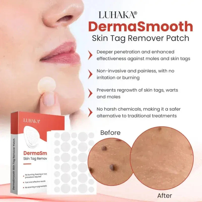Derma Smooth Skin Tag Removal Patch (72 Pcs)