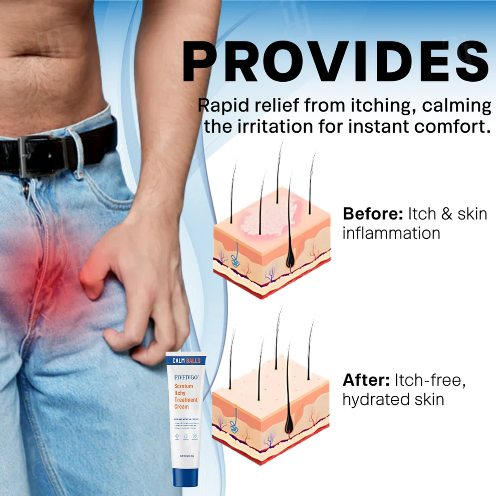 Scrotum Itchy Treatment Cream With Free Delivery