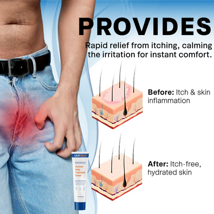 Scrotum Itchy Treatment Cream With Free Delivery